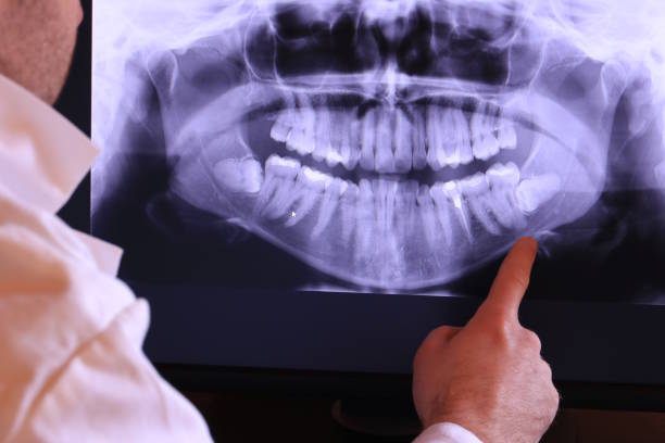 Best Emergency Dentist for Knocked-Out Tooth in Darrington, WA